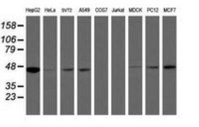 Western Blot: Isocitrate Dehydrogenase 1/IDH1 Antibody (OTI3G9) [NBP2-46018]