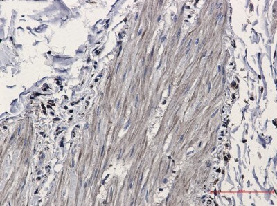 Immunohistochemistry-Paraffin: Isocitrate Dehydrogenase 1/IDH1 Antibody (S05-2G5) [NBP3-19494]