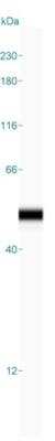 Simple Western: Isocitrate Dehydrogenase 1/IDH1 Antibody [NBP2-34091]