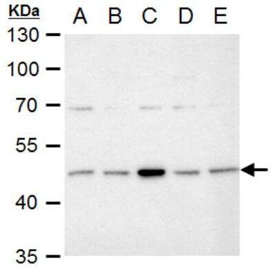 Western Blot: Isocitrate Dehydrogenase 1/IDH1 Antibody [NBP1-31599]