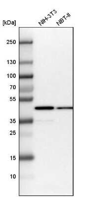 Western Blot: Isocitrate Dehydrogenase 1/IDH1 Antibody [NBP1-87428]