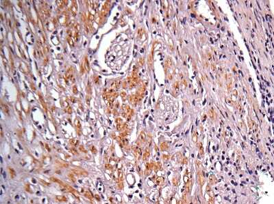Immunohistochemistry-Paraffin: Isocitrate Dehydrogenase 1/IDH1 Antibody [NBP1-31599]