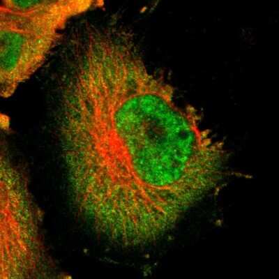 Immunocytochemistry/ Immunofluorescence: Isopeptidase T/USP5 Antibody [NBP1-83089]