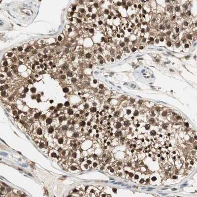 Immunohistochemistry-Paraffin: Isopeptidase T/USP5 Antibody [NBP1-83089]