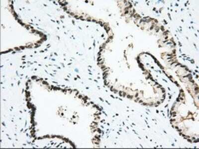 Immunohistochemistry: Isopeptidase T/USP5 Antibody (OTI2E3) - Azide and BSA Free [NBP2-71355]