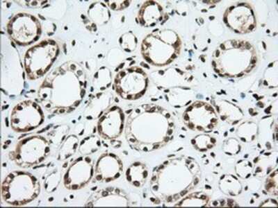 Immunohistochemistry: Isopeptidase T/USP5 Antibody (OTI2E3) - Azide and BSA Free [NBP2-71355]