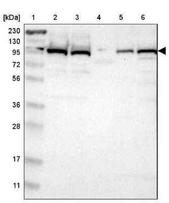 Western Blot: Isopeptidase T/USP5 Antibody [NBP1-83089]