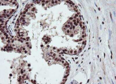 Immunohistochemistry-Paraffin: JAB1 Antibody (OTI2B12) [NBP2-01813]