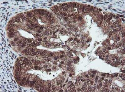 Immunohistochemistry-Paraffin: JAB1 Antibody (OTI2B12) [NBP2-01813]