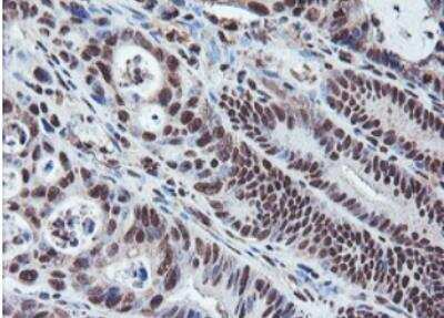 Immunohistochemistry-Paraffin: JAB1 Antibody (OTI2B12) [NBP2-01813]