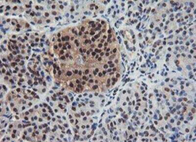 Immunohistochemistry-Paraffin: JAB1 Antibody (OTI2B12) [NBP2-01813]