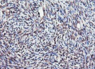 Immunohistochemistry-Paraffin: JAB1 Antibody (OTI2B12) [NBP2-01813]