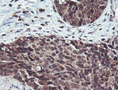 Immunohistochemistry-Paraffin: JAB1 Antibody (OTI2B12) [NBP2-01813]