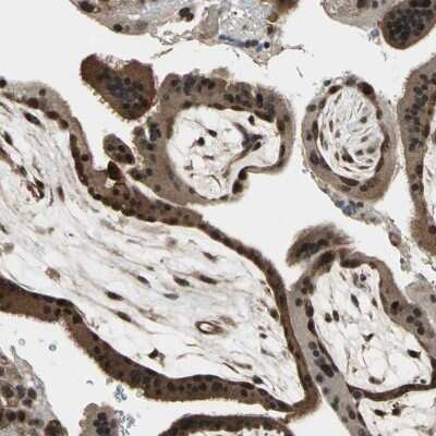 Immunohistochemistry-Paraffin: JAB1 Antibody [NBP1-84370]