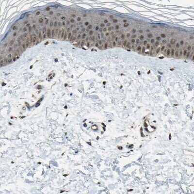Immunohistochemistry-Paraffin: JAB1 Antibody [NBP1-84370]