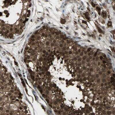 Immunohistochemistry-Paraffin: JAB1 Antibody [NBP1-84370]