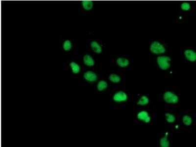 Immunocytochemistry/ Immunofluorescence: JAB1 Antibody (OTI2B12) - Azide and BSA Free [NBP2-71659]