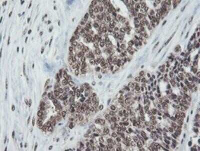 Immunohistochemistry: JAB1 Antibody (OTI2B12) - Azide and BSA Free [NBP2-71659]