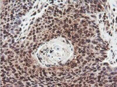 Immunohistochemistry: JAB1 Antibody (OTI2B12) - Azide and BSA Free [NBP2-71659]