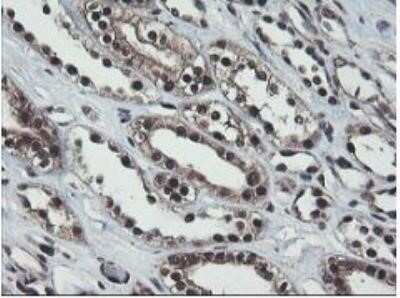 Immunohistochemistry: JAB1 Antibody (OTI2B12) - Azide and BSA Free [NBP2-71659]