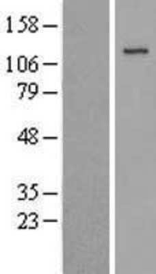 Western Blot: Jak3 Overexpression Lysate [NBL1-12094]