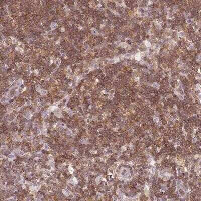 Immunohistochemistry-Paraffin: JAKMIP1 Antibody [NBP2-14137]