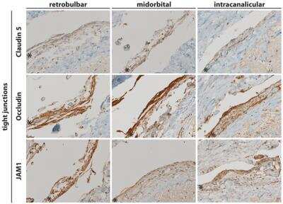 Immunohistochemistry: JAM-A Antibody (2E3-1C8) [H00050848-M01]