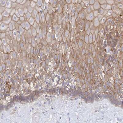 Immunohistochemistry-Paraffin: JAM-A Antibody [NBP2-38934]