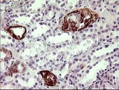 Immunohistochemistry: JAM-A Antibody (OTI3H3) [NBP2-45560]