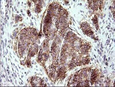 Immunohistochemistry: JAM-A Antibody (OTI3H3) [NBP2-45560]