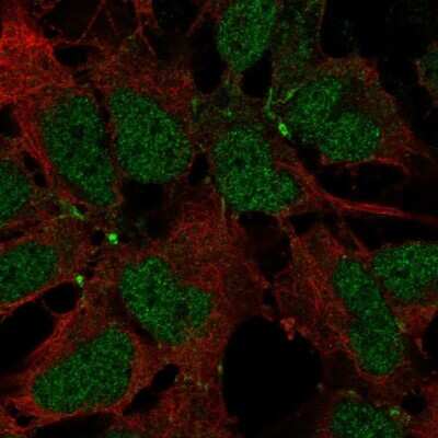 Immunocytochemistry/ Immunofluorescence: JAM-B/VE-JAM Antibody [NBP2-68604]