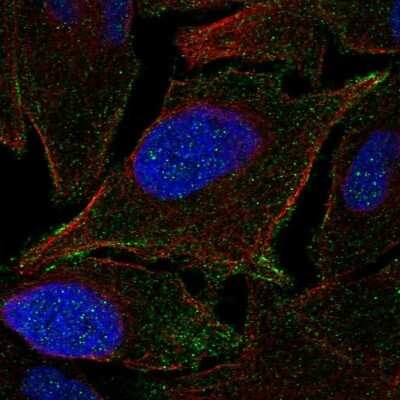 Immunocytochemistry/ Immunofluorescence: JAM-B/VE-JAM Antibody [NBP2-69035]