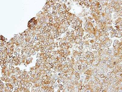 Immunohistochemistry-Paraffin: JAM-B/VE-JAM Antibody [NBP1-32655]