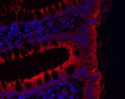 Immunohistochemistry-Paraffin: JAM-B/VE-JAM Antibody [NBP1-32655]