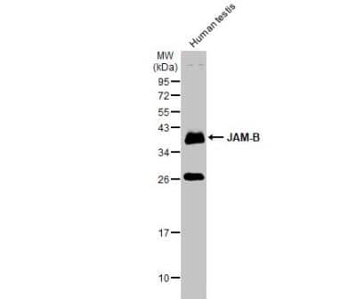 Western Blot: JAM-B/VE-JAM Antibody [NBP1-32655]