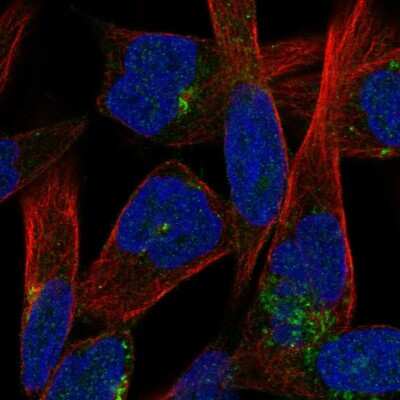 Immunocytochemistry/ Immunofluorescence: JAM-C Antibody [NBP2-58727]