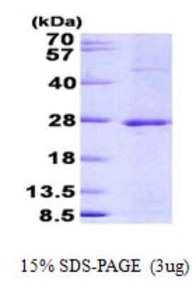 SDS-PAGE: Recombinant Human JDP2 His Protein [NBP2-23158]