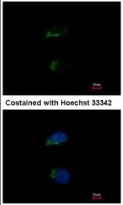 Immunocytochemistry/ Immunofluorescence: JIK Antibody [NBP1-32181]