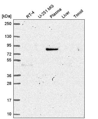 Western Blot: JIP1 Antibody [NBP2-58545]