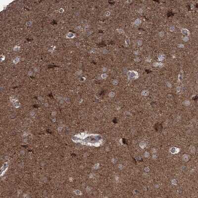 Immunohistochemistry-Paraffin: JIP2 Antibody [NBP1-89638]