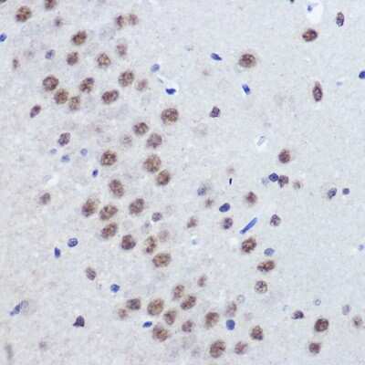 Immunohistochemistry-Paraffin: JMJD1C Antibody - Azide and BSA Free [NBP3-15959]