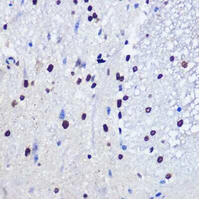 Immunohistochemistry-Paraffin: JMJD1C Antibody - Azide and BSA Free [NBP3-15959]