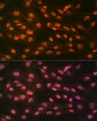 Immunocytochemistry/ Immunofluorescence: JMJD2B Antibody (8I0I1) [NBP3-16639]