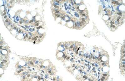 Immunohistochemistry: JMJD2D Antibody [NBP2-87645]