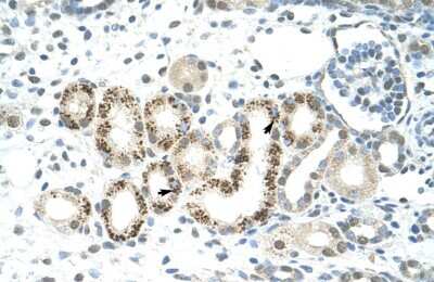 Immunohistochemistry: JMJD2D Antibody [NBP2-87645]