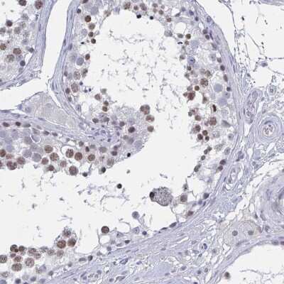 Immunohistochemistry-Paraffin: JMJD2D Antibody [NBP2-47413]