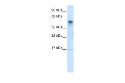 Western Blot: JMJD5 Antibody [NBP2-82258]