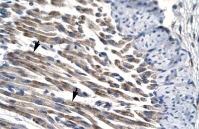 Immunohistochemistry: JMJD8 Antibody [NBP2-86687]
