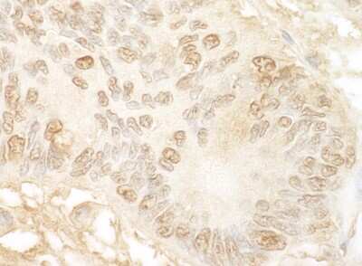 Immunohistochemistry: JMY Antibody [NBP1-30464]