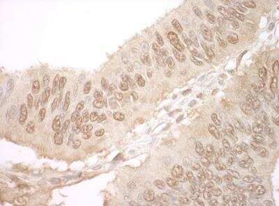 Immunohistochemistry-Paraffin: JMY Antibody [NBP1-30464]